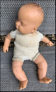 Andy B.'s doll before treatment
