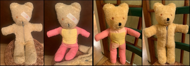 Ruth S.'s Billy before and after treatment